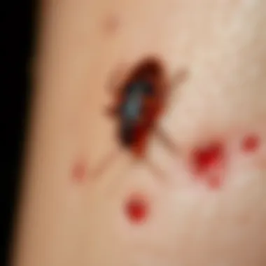 Identifying Bed Bug Bites Visual representation of common bed bug bites on skin